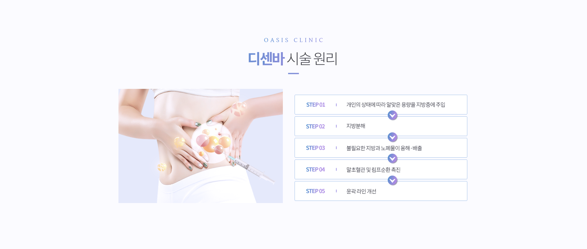 디센바 시술 원리