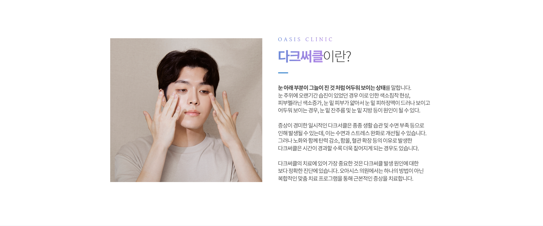 다크써클이란?