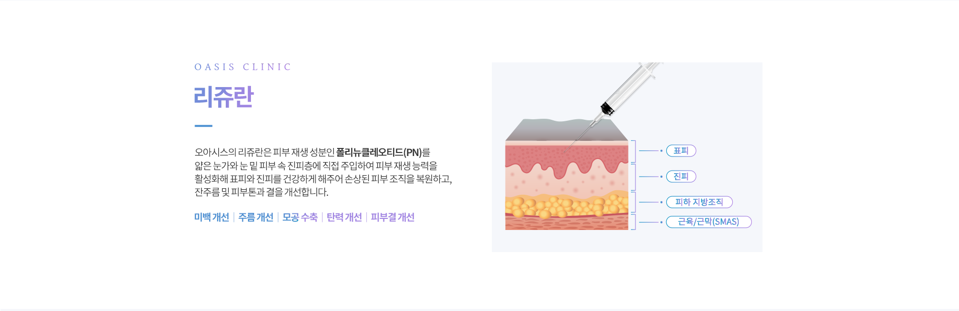 리쥬란