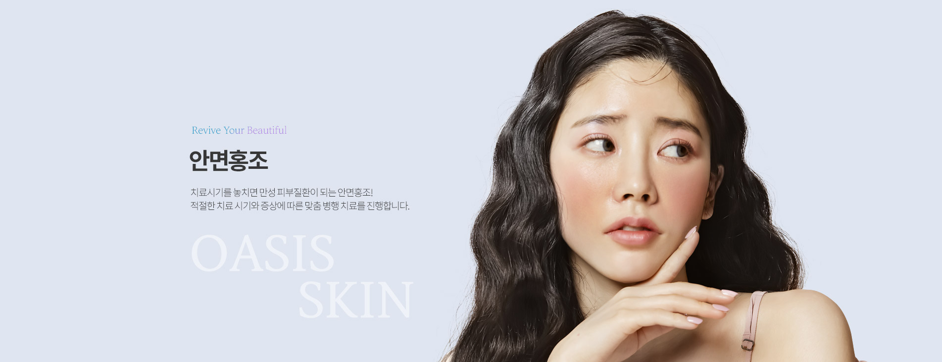 안면홍조 상단