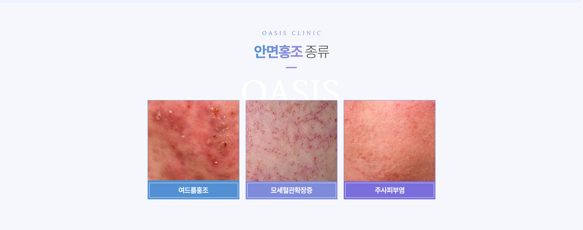 안면홍조 종류