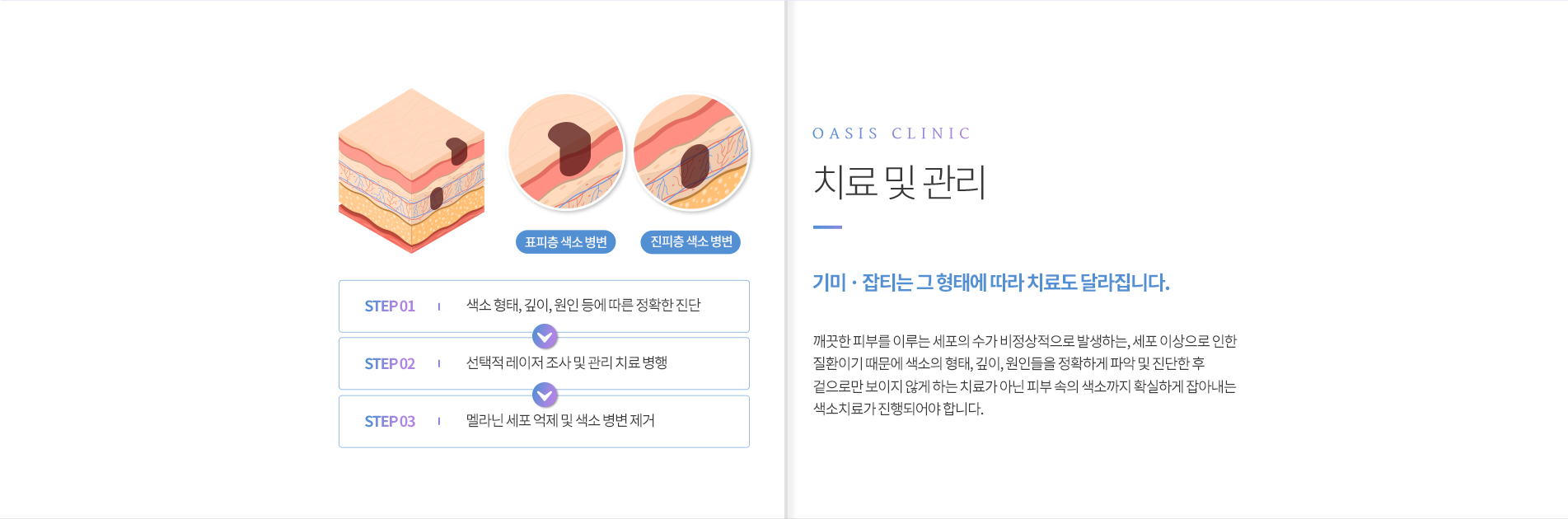 치료 및 관리