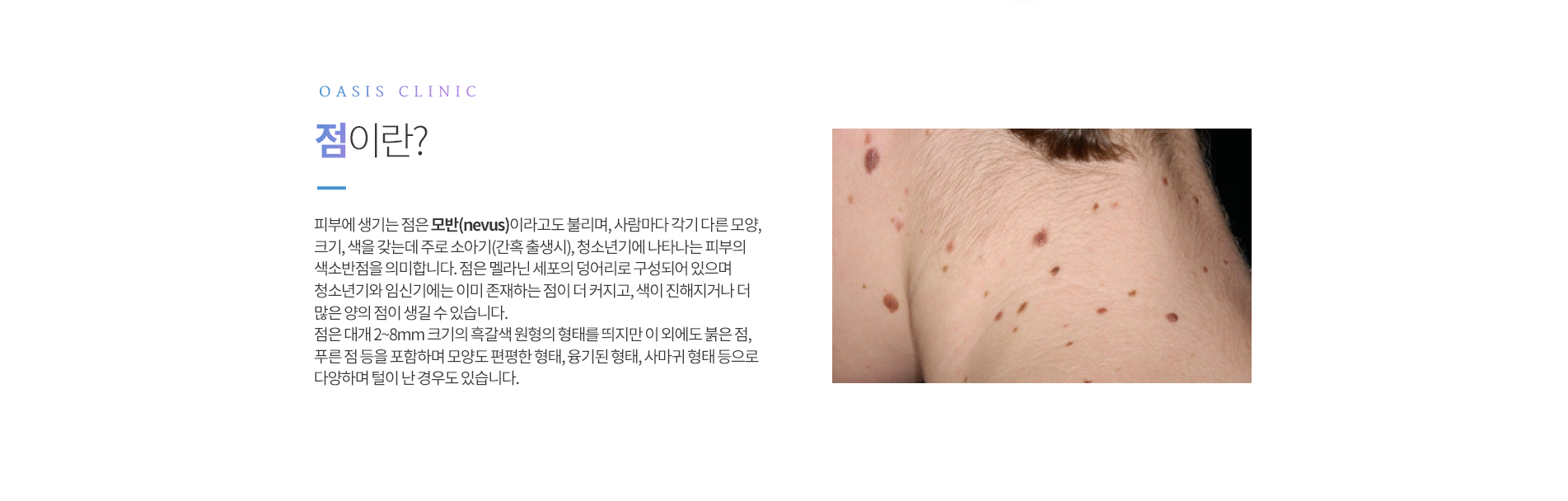 점이란?