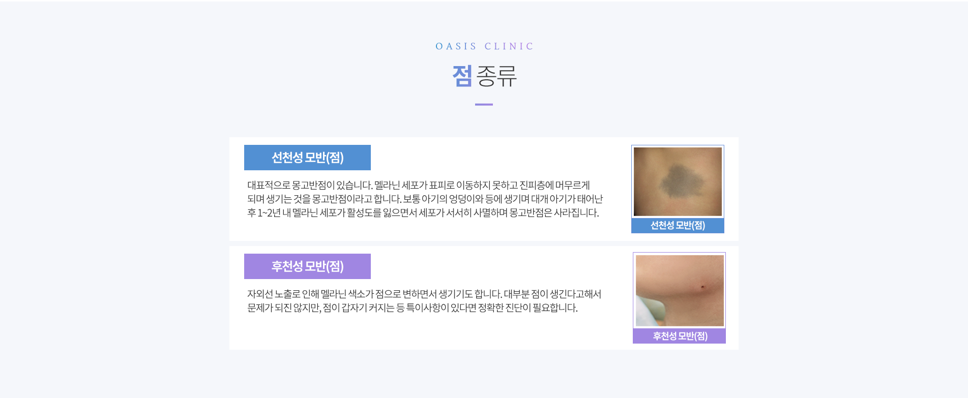 점 종류