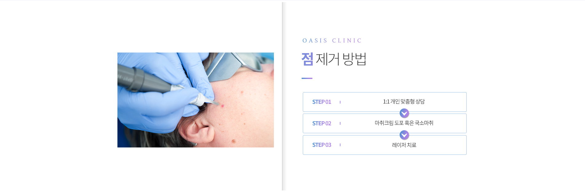 점 제거 방법