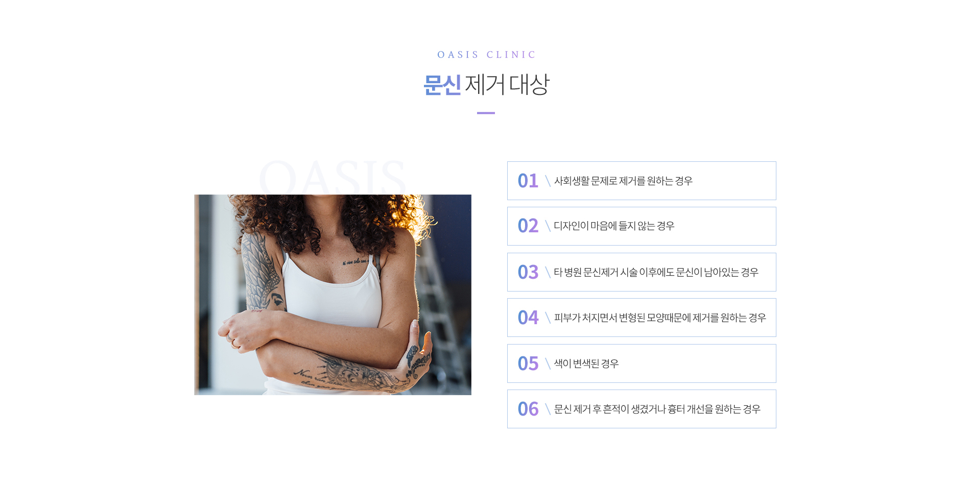 문신제거 대상